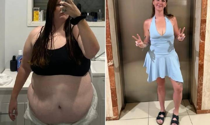 Jovem emagrece 63 quilos sem caneta ou cirurgia
