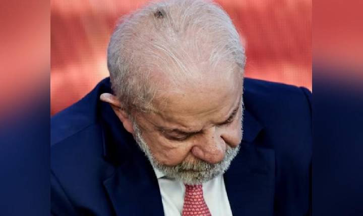 Lula fará retirada de acúmulo de pele na cabeça e infiltração no punho para tratar tendinite, diz Planalto